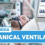 Kurs mehaničke ventilacije